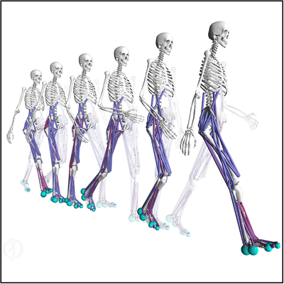 Creen un nou sistema computacional per personalitzar el tractament de pacients amb malalties neuromusculars